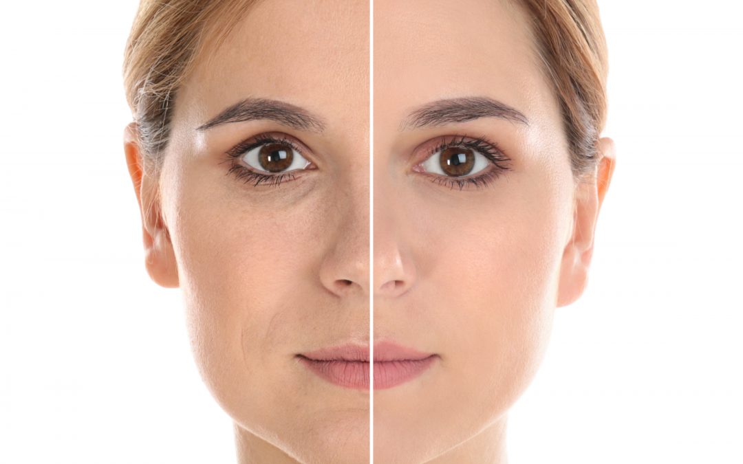 Lifting Facial: La Solución Más Efectiva para Rejuvenecer el Rostro y Recuperar la Firmeza